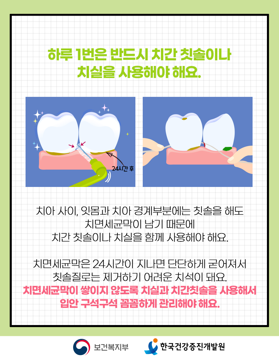 치아 사이와 잇몸경계부는 칫솔질이 잘 안되기 때문에 치간칫솔이나 치실을 함께 사용해야 합니다.